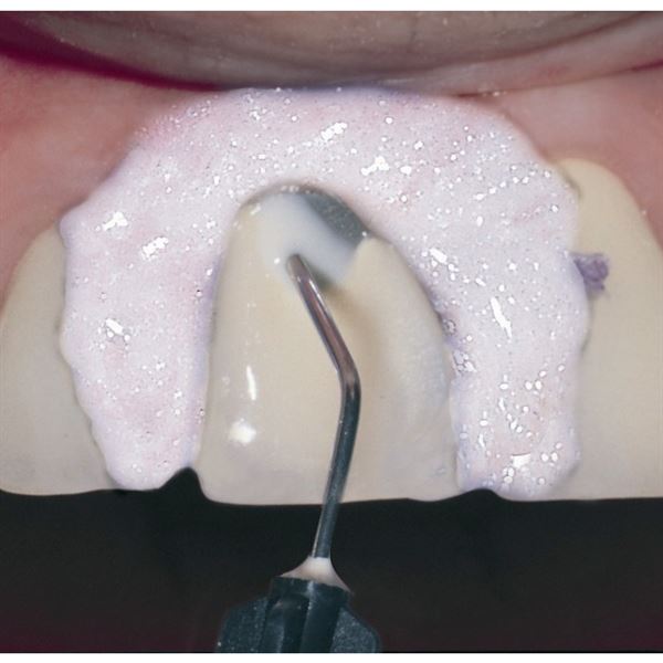 PermaFlo 2 x 1,2 ml +4 kanyly  dentin-opaquer