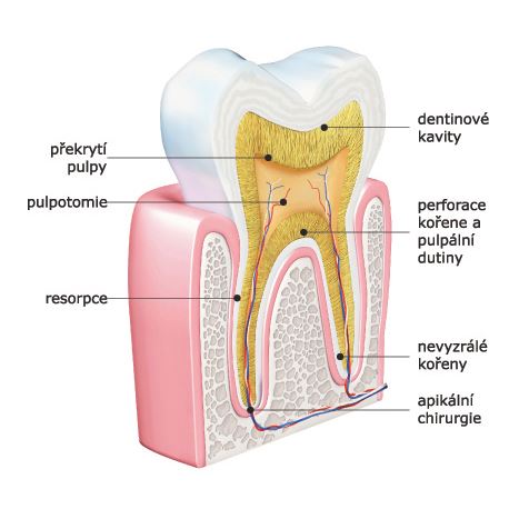 Biodentine 5 x 0,7 g