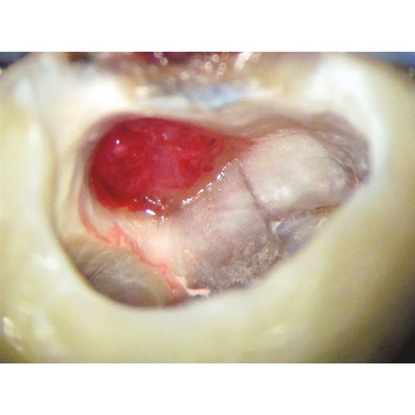 Biodentine 5 x 0,7 g